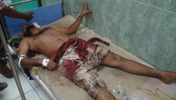 حقوق الإنسان العربية: جرائم حرب ارتكبها الانقلابيين في عدن