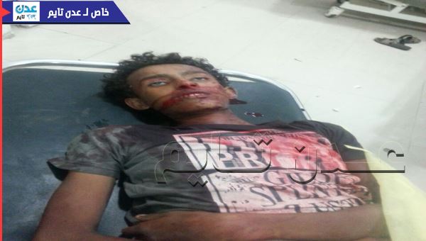 قتيل و3 جرحى برصاص مسلحين هاجموا عناصر الشيخ العقربي بعدن (صور )